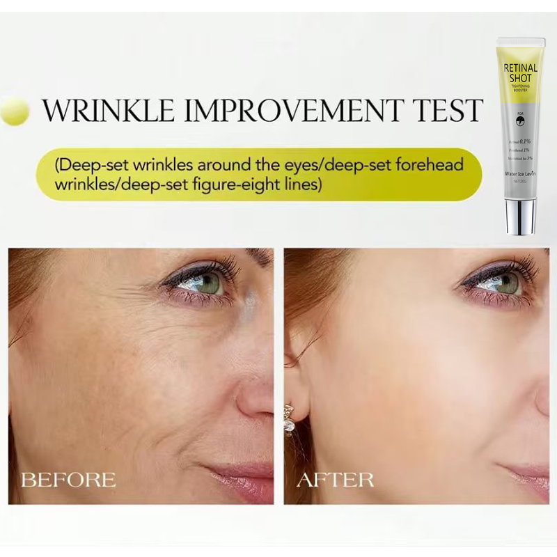 Retinal 0,1% Intensiv-Serum mi – Retinol Anti Wrinkle Cream Bewertung und Preis