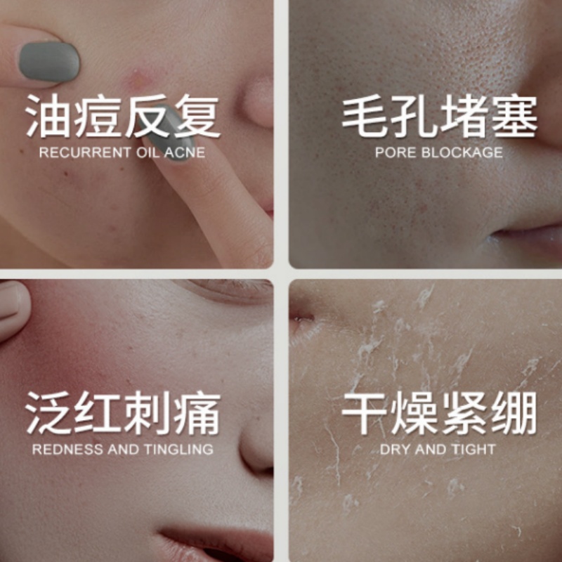Centella Asiatica Salicylsäure – Salicylic Acid Blackhead Remover Bewertung und Preis